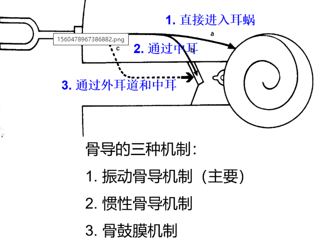 【聽力科普】堵耳效應——堵住聲音的退路(圖4)